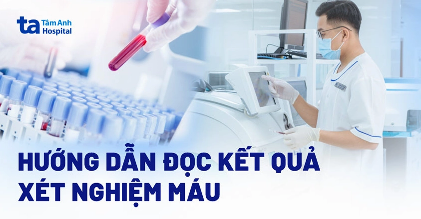 Cách đọc kết quả xét nghiệm máu tổng quát chi tiết dễ hiểu nhất