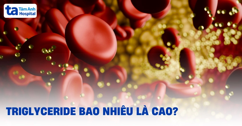 Chỉ số Triglyceride cao là bao nhiêu? Xét nghiệm và cách phòng ngừa