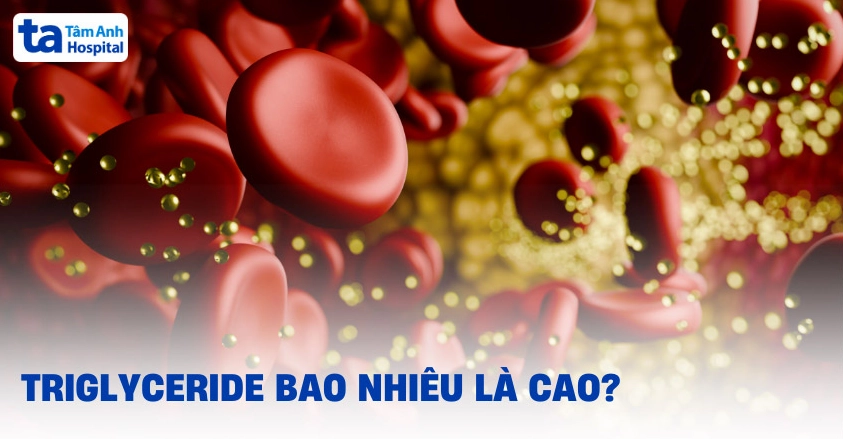 Chỉ số Triglyceride cao là bao nhiêu? Xét nghiệm và cách phòng ngừa