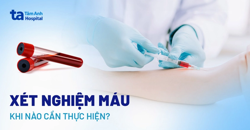 Xét nghiệm máu là gì? Khi nào cần thực hiện? Lưu ý quan trọng