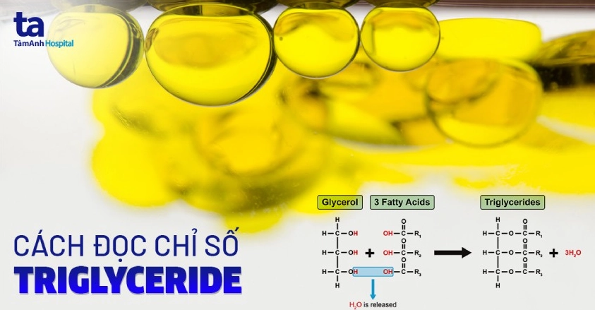 Xét nghiệm Triglyceride là gì? Cách đọc các chỉ số chẩn đoán bệnh