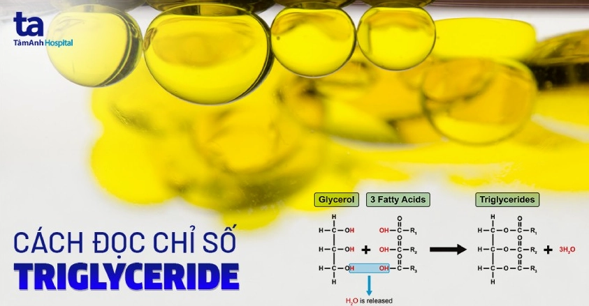 Xét nghiệm Triglyceride là gì? Cách đọc các chỉ số chẩn đoán bệnh