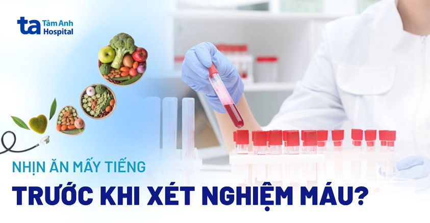 Xét nghiệm máu có cần nhịn ăn không? Lưu ý quan trọng cần biết